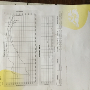 Dyno bank 2