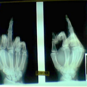 finger.jpg