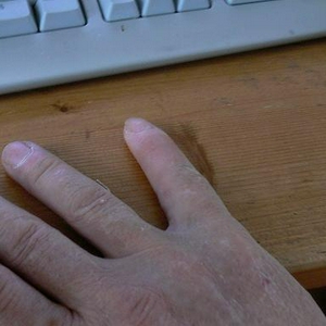 Pinky.jpg