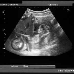 scan02mf.jpg