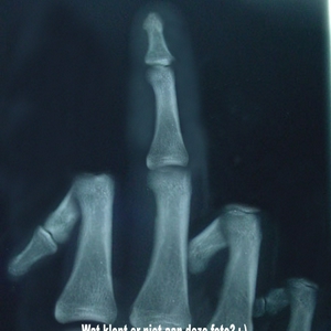 TheFinger.jpg