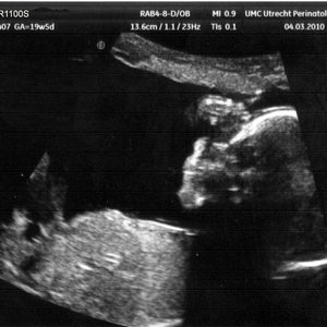 babietje.jpg